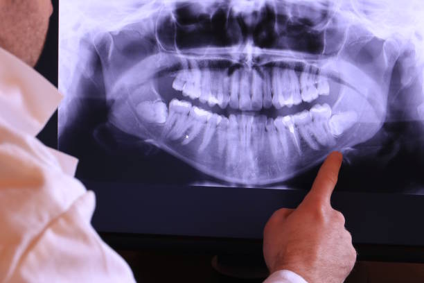 Best Dentist for Tooth Abscess  in Lake Of The Woods, VA